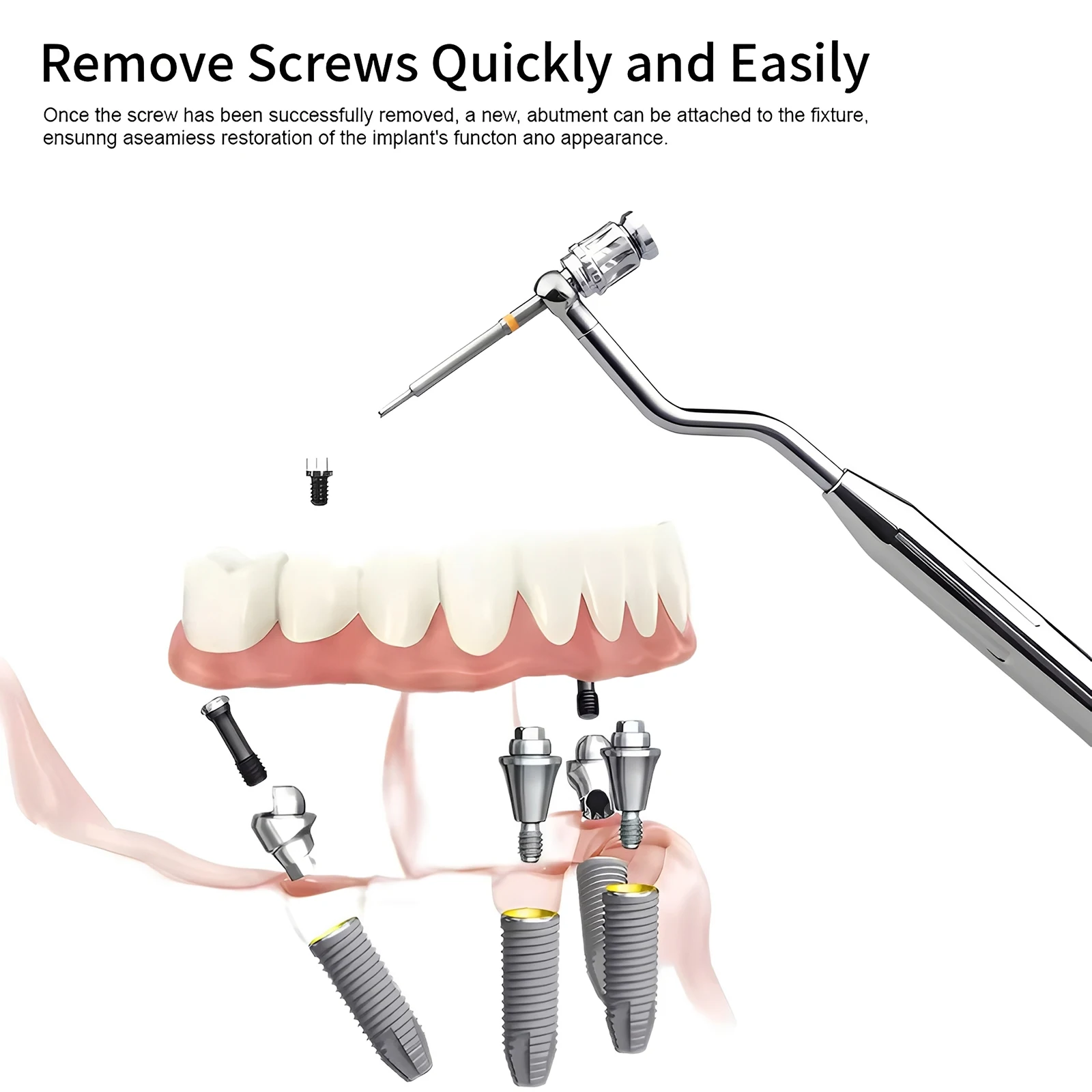 Dental Universal Implant Removal Kit Stainless Steel Screws Golden/Plastic Box Broken Screws Extract
