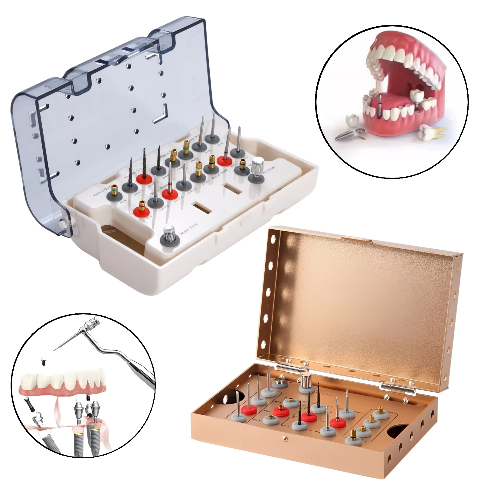 Dental Universal Implant Removal Kit Stainless Steel Screws Golden/Plastic Box Broken Screws Extract