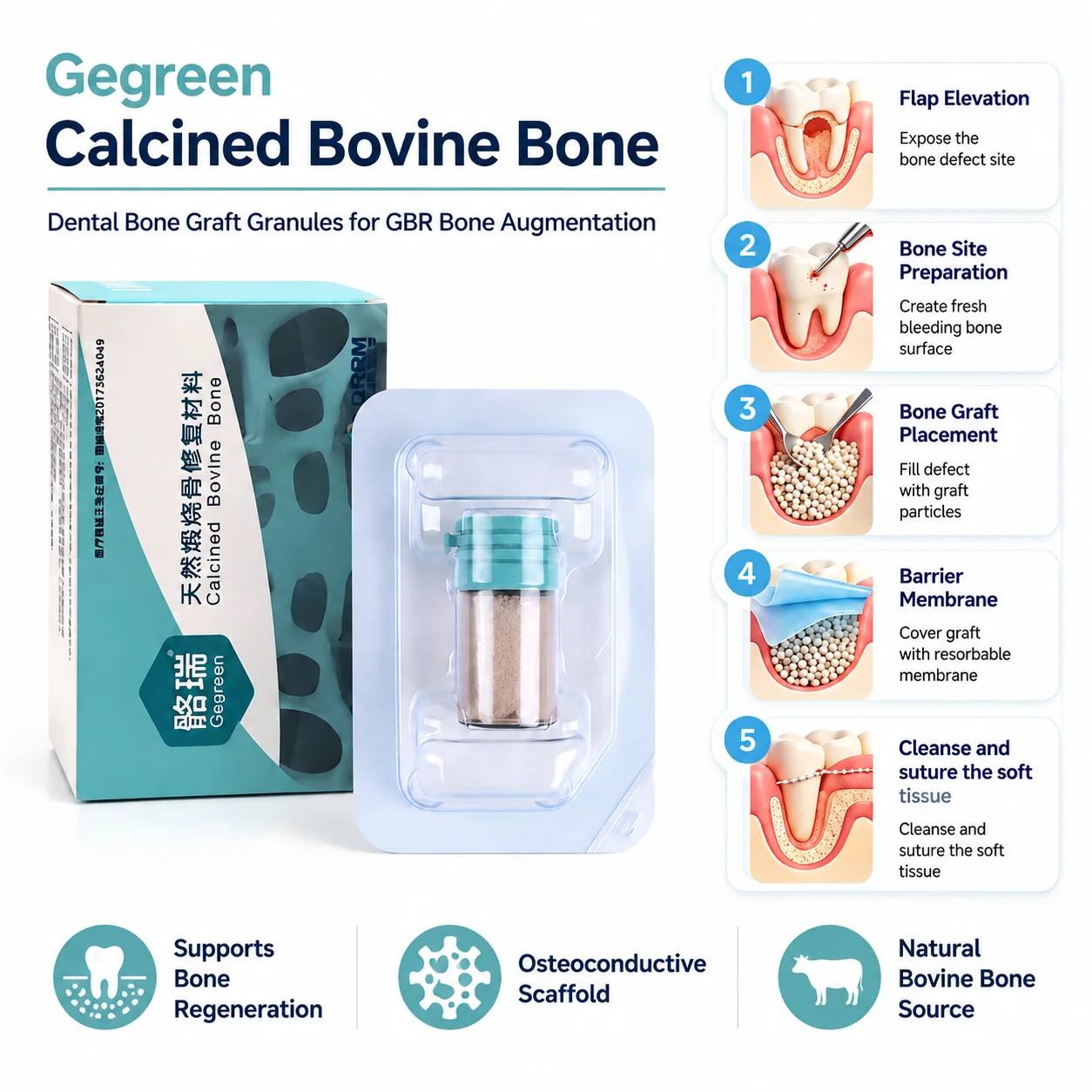 Dental Resorbable Collagen Membrane Bone Graft Powder Dental GBR Kit Guided Bone Regeneration Implant Bone Augmentation Surgery