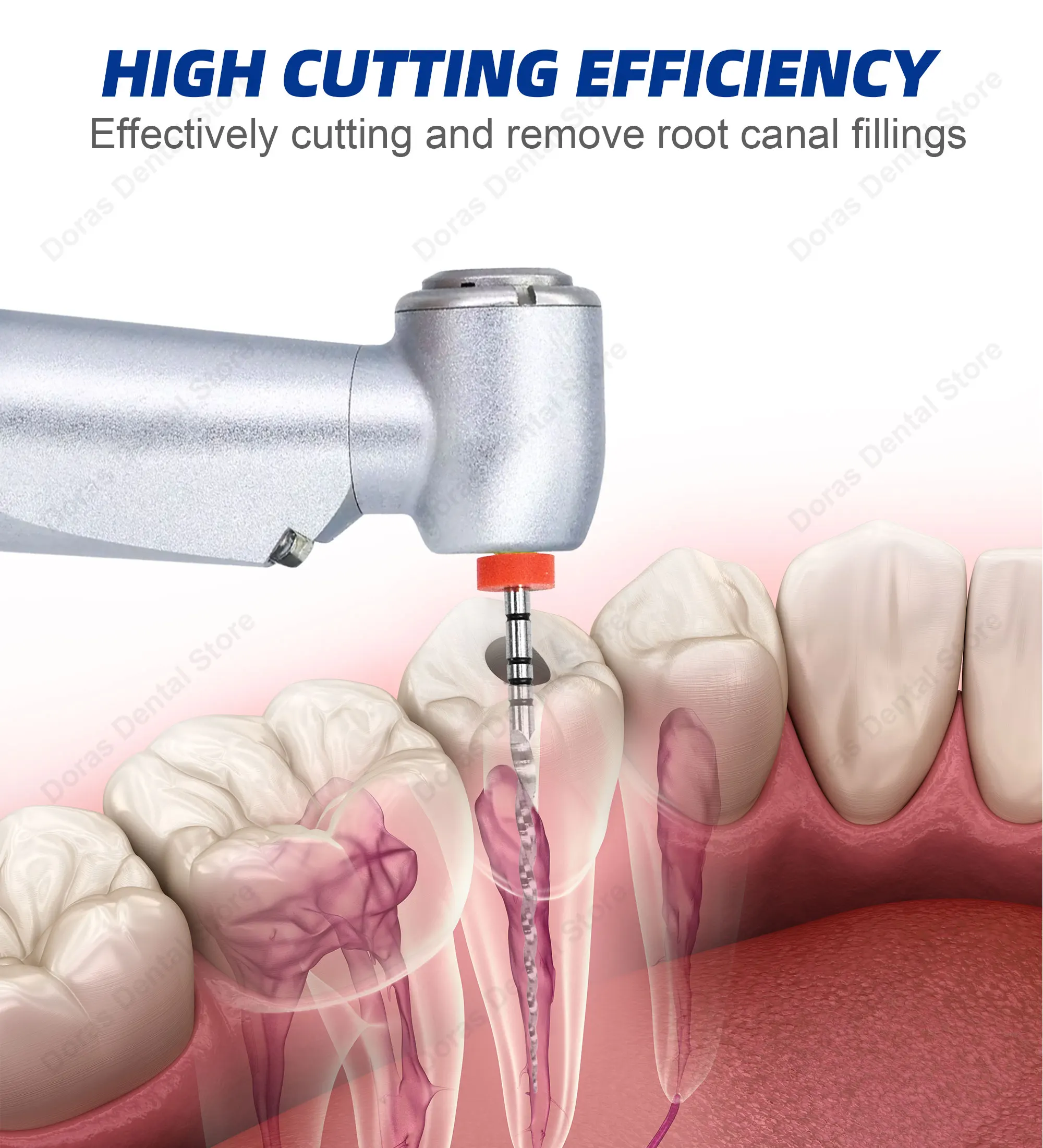 Glin Dental Root Canal Rotary Files 3Pcs/Box Safety Tip Niti Endo Files 21/25mm Dentistry Instrument W-One Endodontics Files
