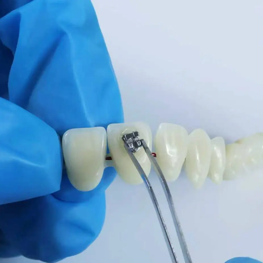 Dental Orthodontic Adhesive Light-Cure Self-Cure Kit Etchant Acid Gel Light Cure Primer Bonding Brackets Braces Material
