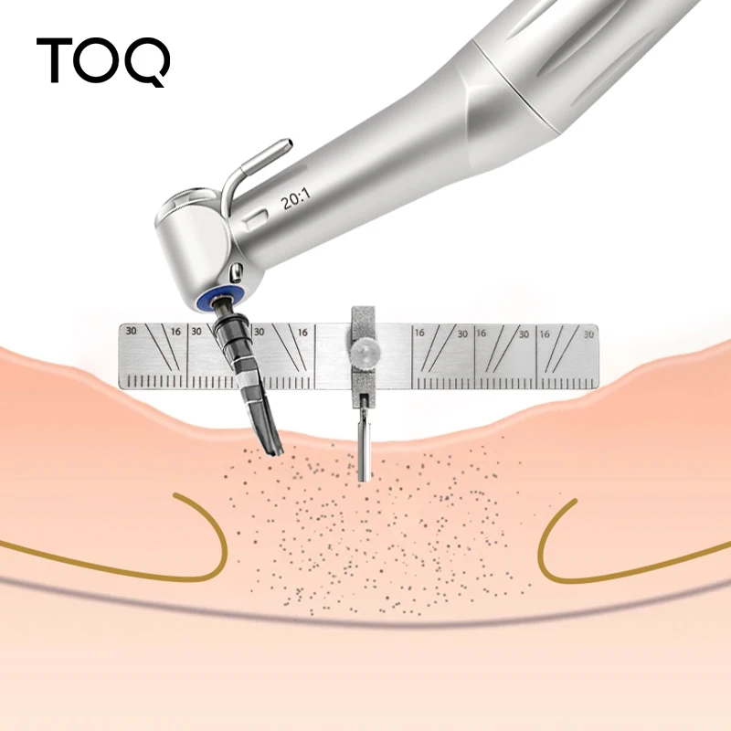 Dental Implant Locating Guide Surgical Planting Positioning Locator Angle Ruler Guage Autoclavable