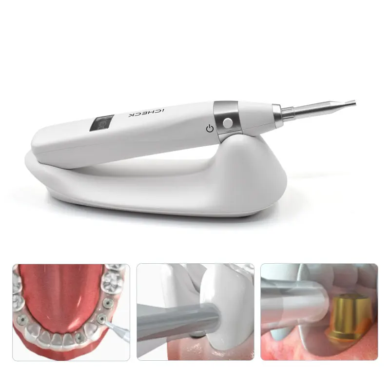 JUMTOP Dental Implant Monitor Oral Implant Stability Measurement Device Dentistry Detector Tools