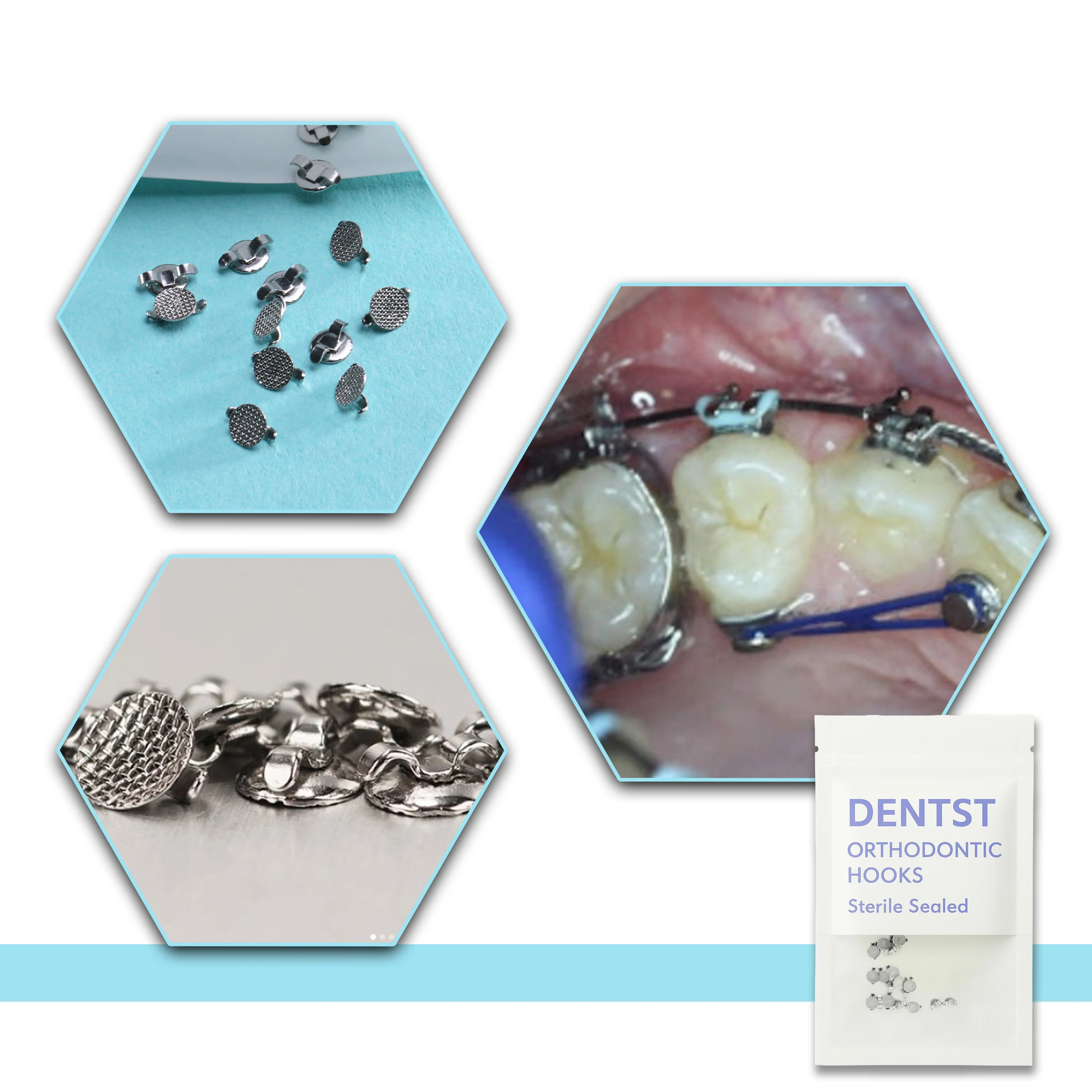 20PCS Dental Orthodontic Lingual Buttons-Bondable Round Mesh Base Composite Clear Ceramic Hook Dentistry Accessories Materials