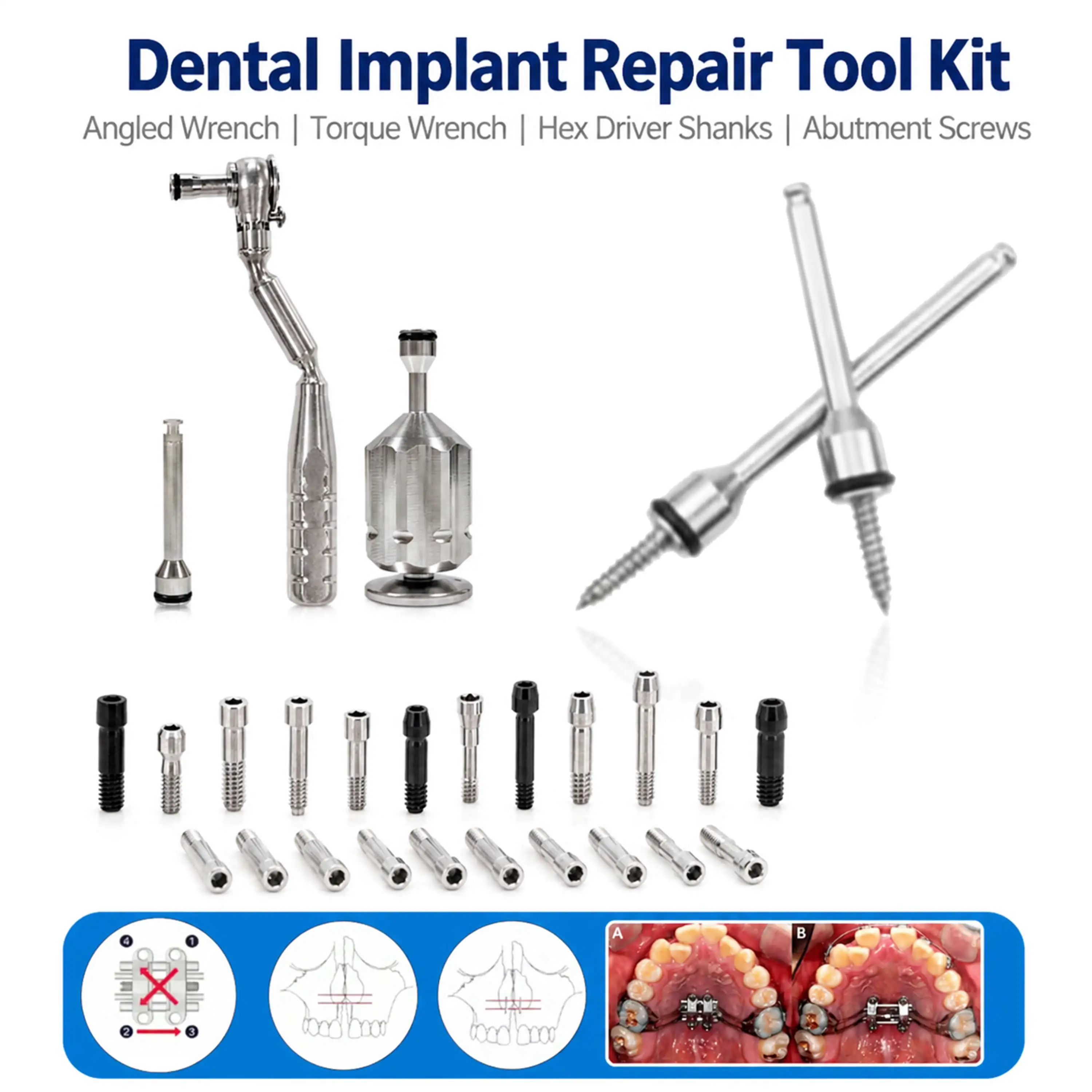 Dental Implant Repair Tool Kit 1.2/1.27mm Hex Driver Shanks with Angled Wrench Torque Wrench Abutment Screws For Osstem Dentium