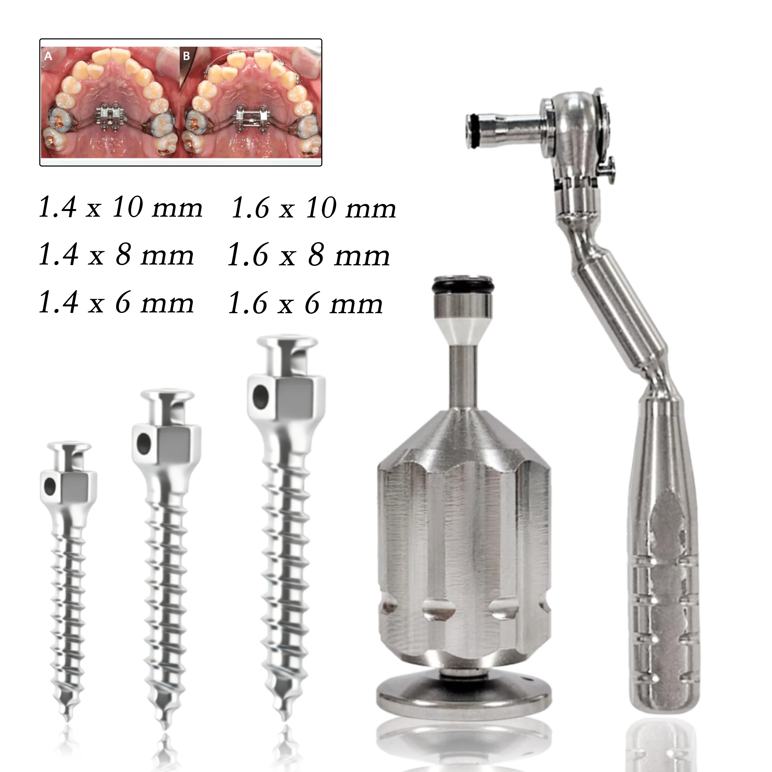 Dental Implant Repair Tool Kit 1.2/1.27mm Hex Driver Shanks with Angled Wrench Torque Wrench Abutment Screws For Osstem Dentium
