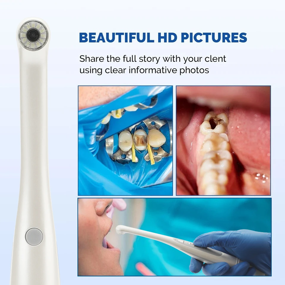 Dental Intraoral Camera USB Digital Imaging Intra Oral 1080P HD Camera 12 LED light Compatible with Win XP/7/8/10/11 for Dentist