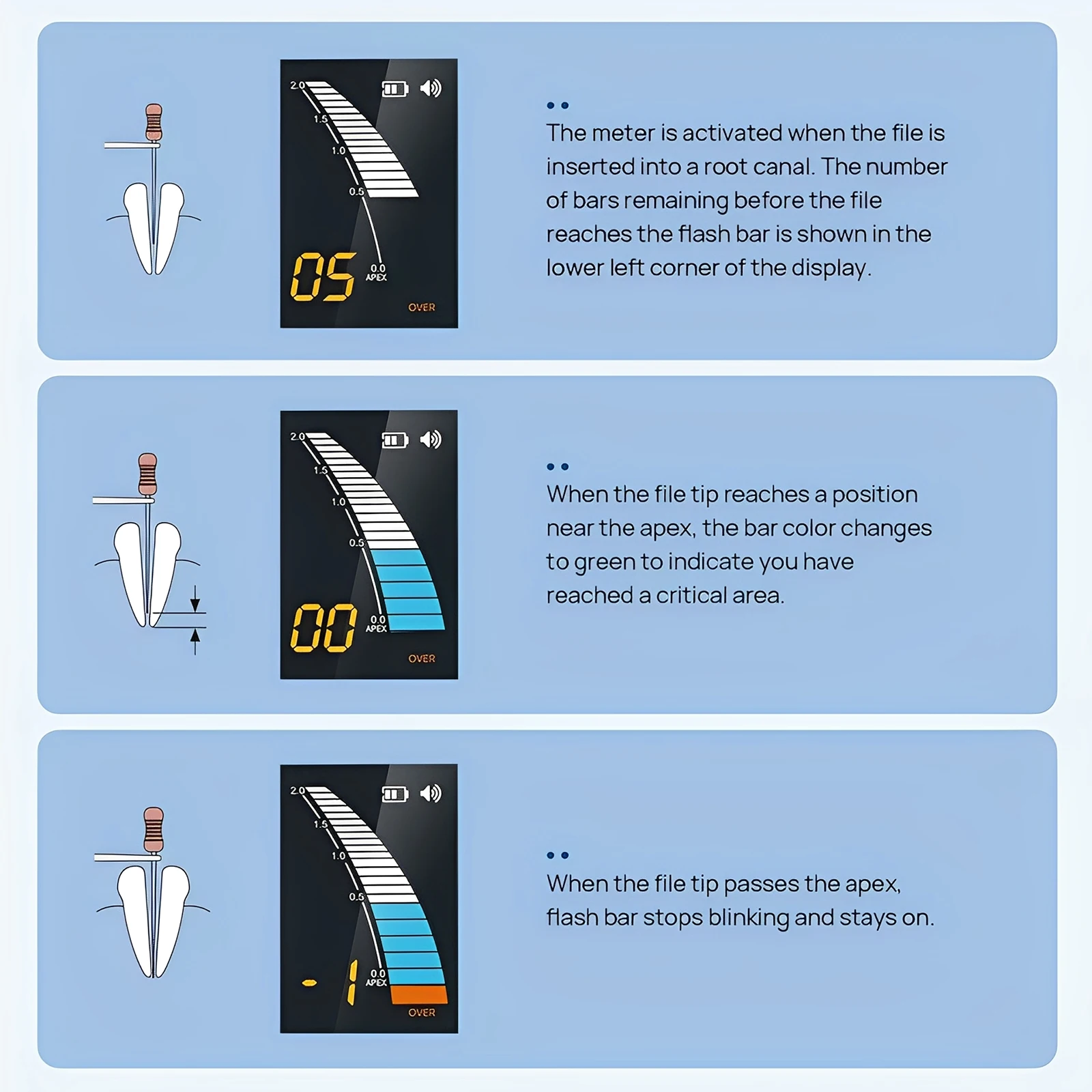 Dental LCD Endo Apex Locator Mini Endodontic Root Canal Finder Measure Instruments Woodpecker Style