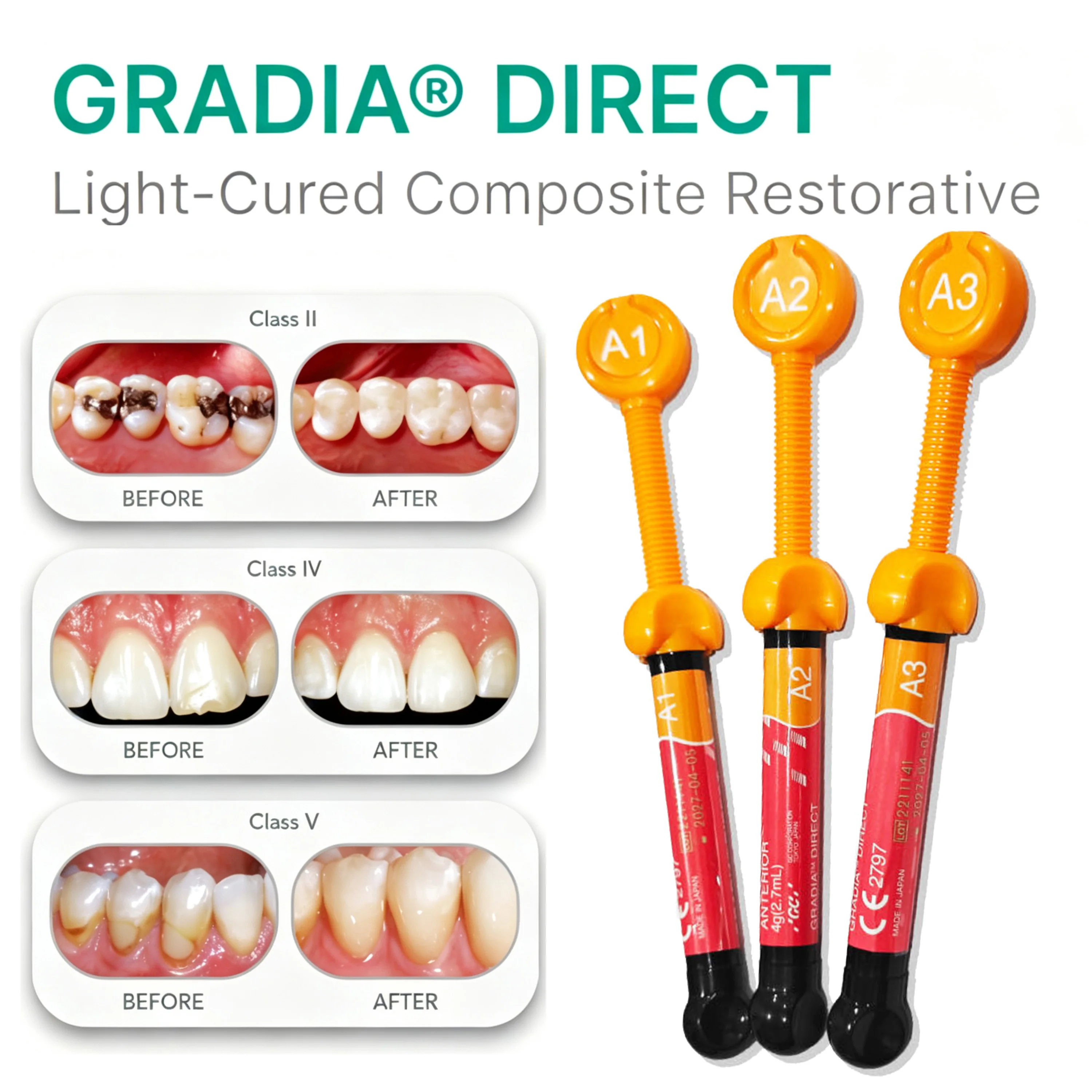 NEW Dental GC Gradia Direct Light‑Cured Composite Restorative 2.7mL  Nano Resin Filling Material for Anterior Posterior Teeth