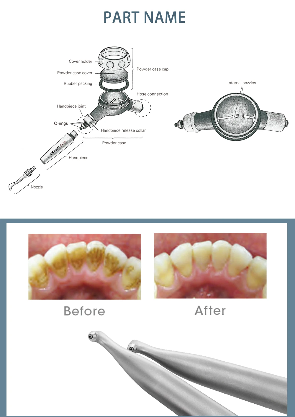 4 Hole Dental Air Polisher Abrasion Microetcher Sandblasting Sandblaster Teeth Polishing Air Prophy Dentistry Tools