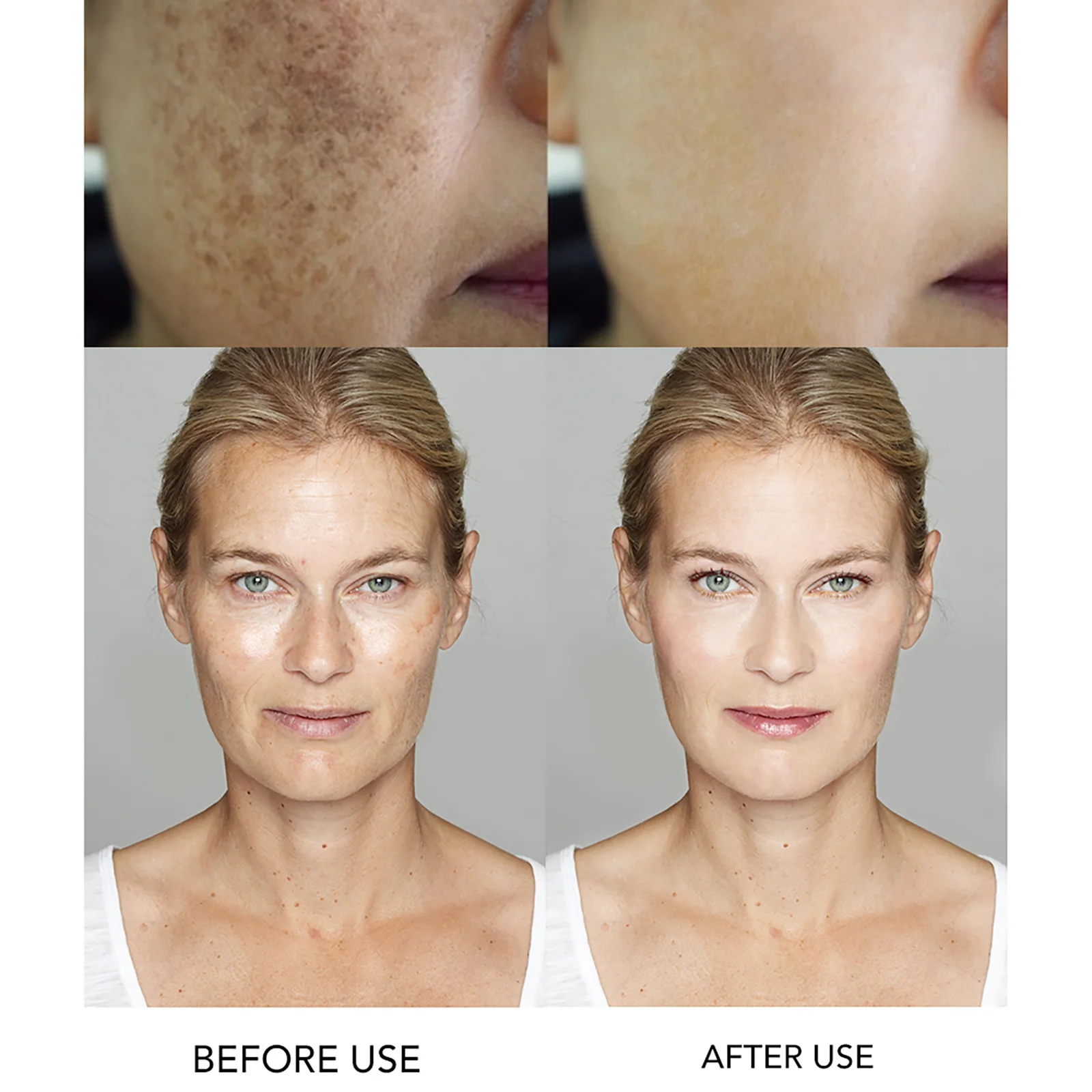 AILKE Face Cream With Hyaluronic Acid, Whitening, Moisturizing, Reduce Wrinkles, Dark Spots, for All Skin Types Beauty Set