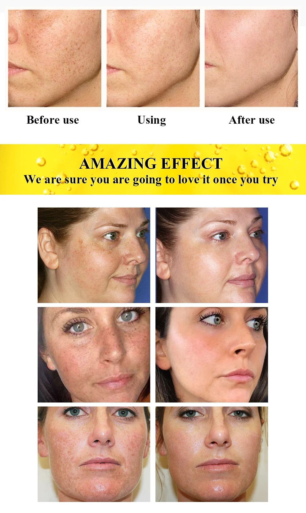 AILKE Face Cream With Hyaluronic Acid, Whitening, Moisturizing, Reduce Wrinkles, Dark Spots, for All Skin Types Beauty Set