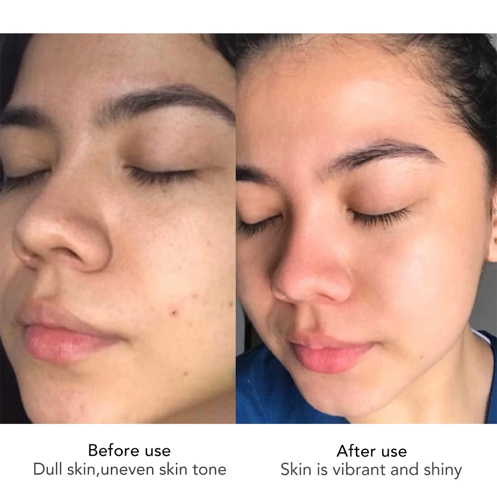 AILKE Face Cream With Hyaluronic Acid, Whitening, Moisturizing, Reduce Wrinkles, Dark Spots, for All Skin Types Beauty Set