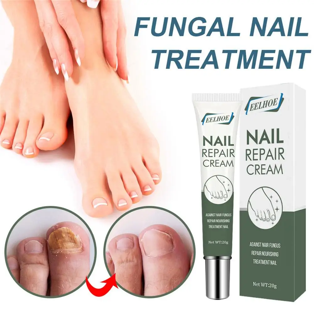 25g Nail Care Cream Anti-fungals Nail Therapy Serum Foot Nail Fungi Removal Gel Anti Infected Paronychia Onychomycosis Product