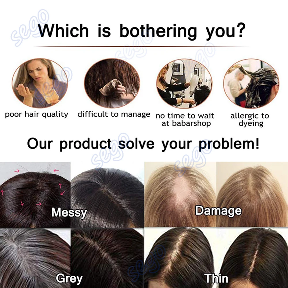 SEGO 10x12cm Women Human Hair Toppers Silk Base Natural Scalp Top Wig Hairpiece Straight 4 Clips In Hair Piece Brown Blonde