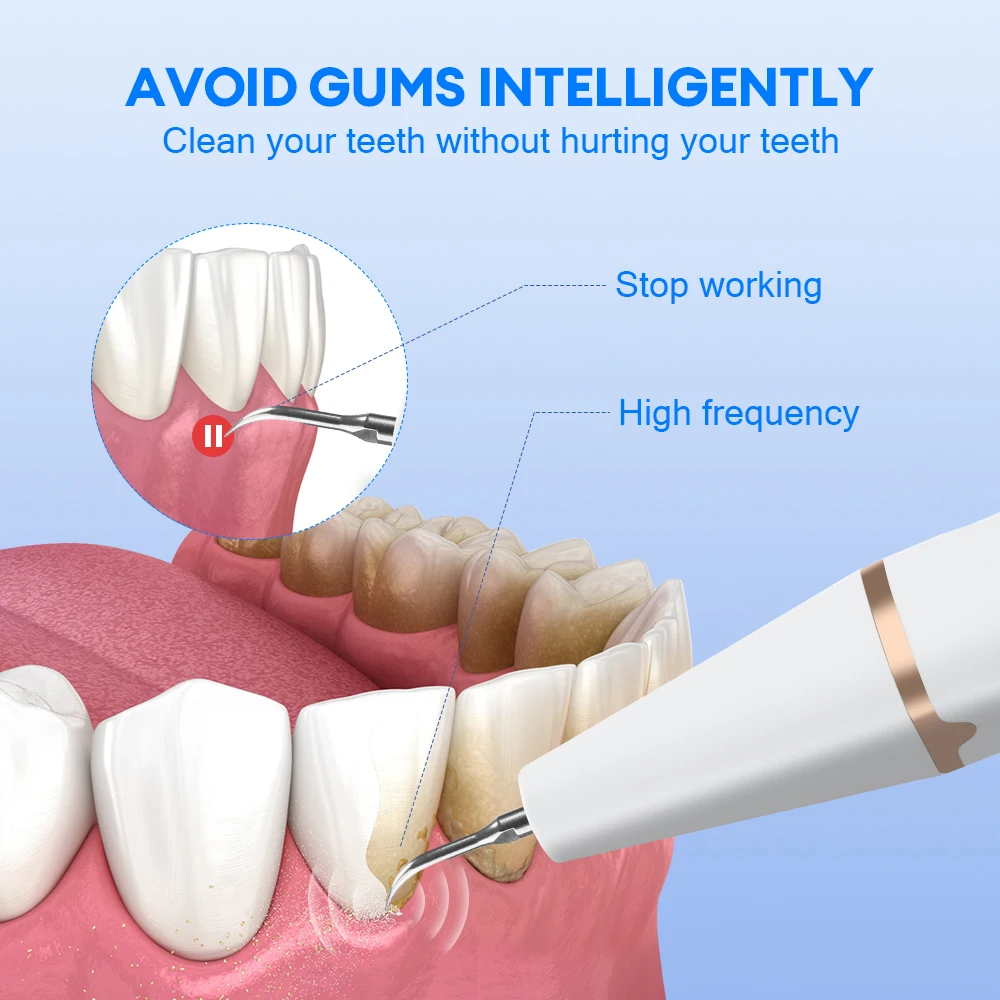 Portable Oral Irrigator Ultrasonic Calculus Remover Electric Teeth Whitening Dental Scaler Plaque Stains Tartar Home Oral Care