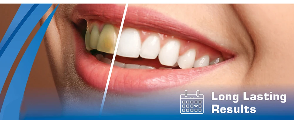 V34 Dental Whitening Toothpaste Instant Teeth Whitening Cleaning Tooth Stain Tartar Removal Oral Hygiene Fresh Breath
