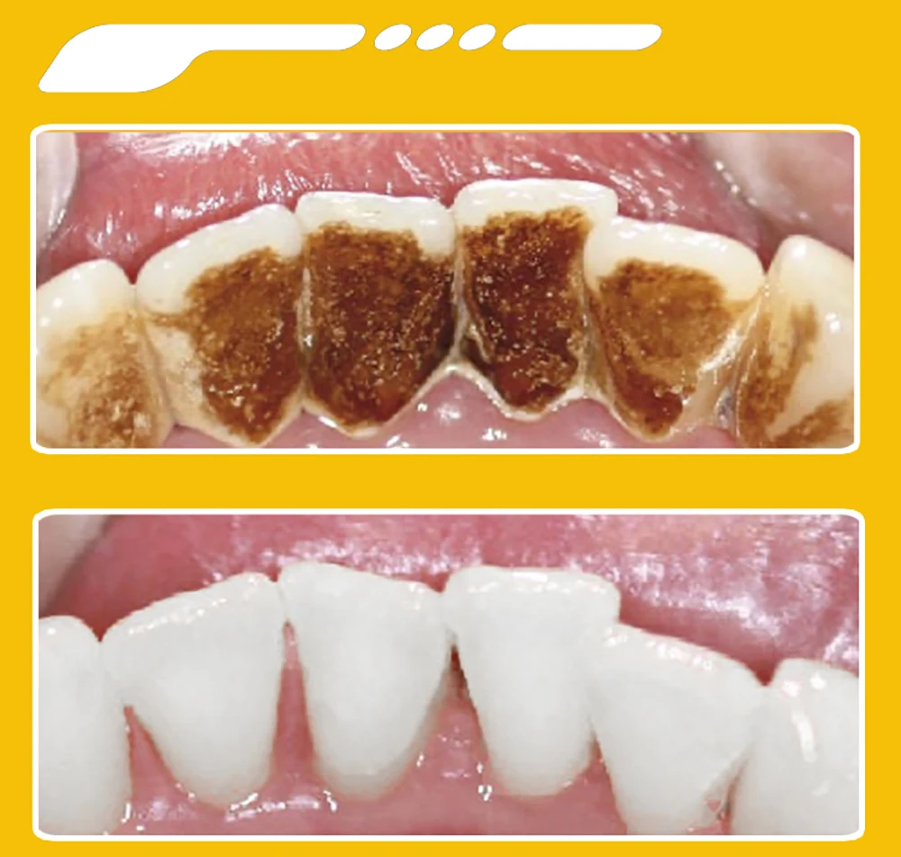 V34 Dental Whitening Toothpaste Instant Teeth Whitening Cleaning Tooth Stain Tartar Removal Oral Hygiene Fresh Breath