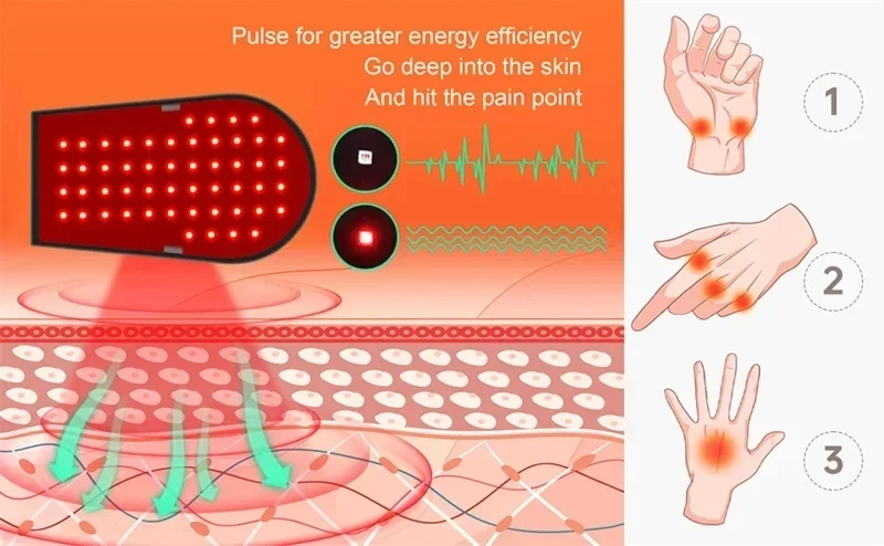 LED Red Light Glove 660nm & 850nm Infrared Light Therapy for Wrist Fingers Hand Arthritis Beauty Fatigue Relief USB Plug-in