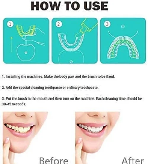Sonic Silicone Electric Toothbrush U Shape 360 Degree Mouth Cleansing Automatic Toothbrush Cold Blue Light Teeth Whitening Brush