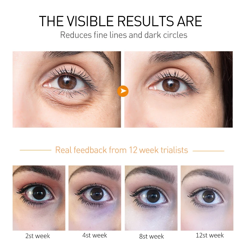 OCHEAL Eye Moisturizing Cream Fades Fine Lines Anti Dark Circles Eye Serum Remove Eye Bag Puffiness Anti-Aging Firmness Eye Care