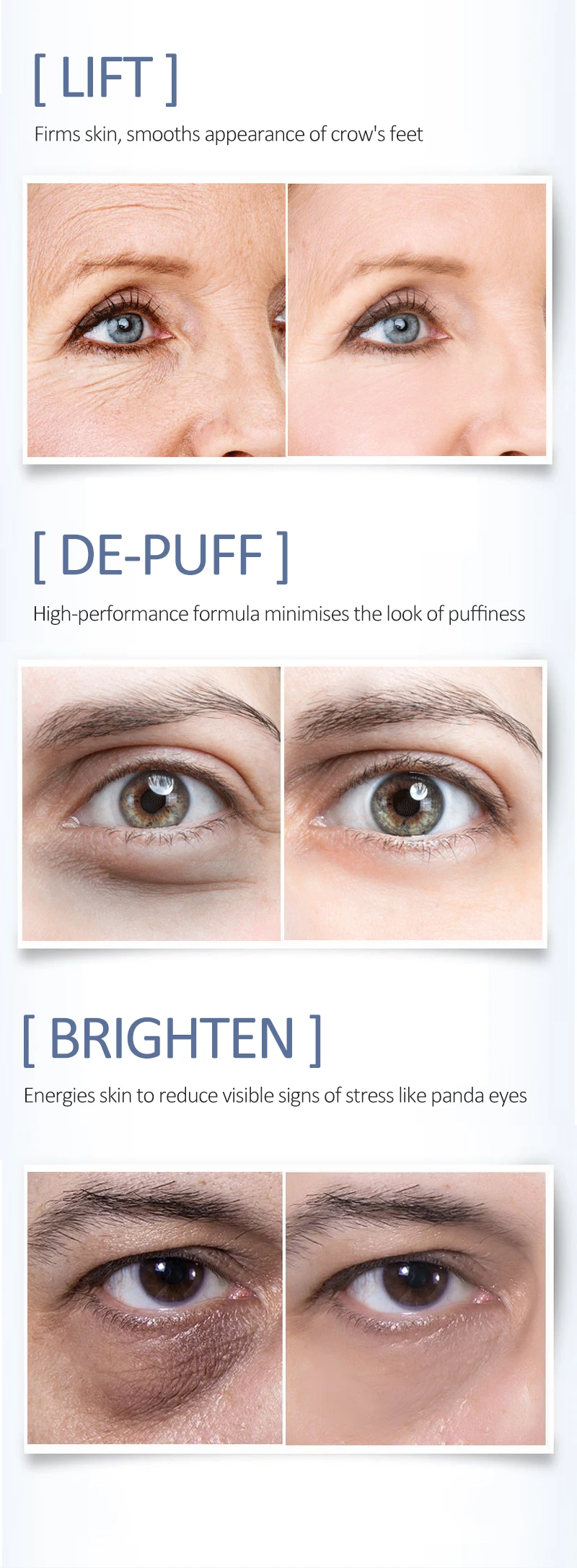 OCHEAL Eye Moisturizing Cream Fades Fine Lines Anti Dark Circles Eye Serum Remove Eye Bag Puffiness Anti-Aging Firmness Eye Care