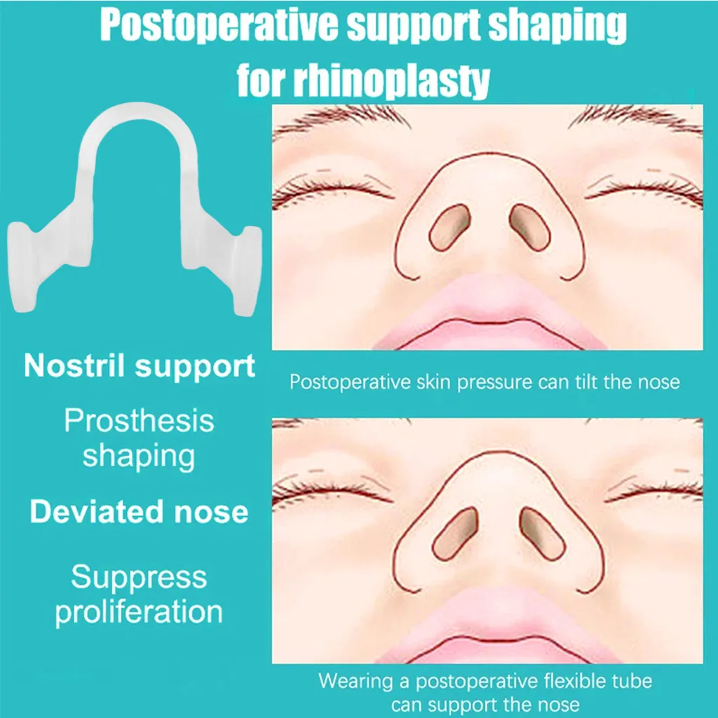 5/10/20Pcs Nose Clip Anti Snoring Soft Nasal Dilator Stop Snore Device for Aid Easy Breathe Improve Sleeping Quality Rhinitis
