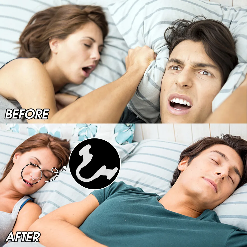 5/10/20Pcs Nose Clip Anti Snoring Soft Nasal Dilator Stop Snore Device for Aid Easy Breathe Improve Sleeping Quality Rhinitis
