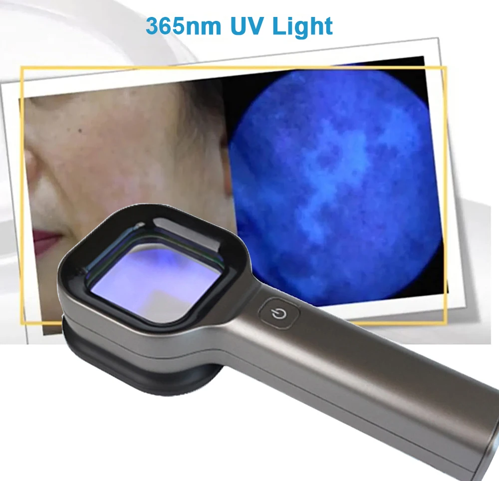 Handheld Wood Lamp for Pet Cat and Dog Skin Detection 365 Nanometer UV Irradiation Veterinary Equipment