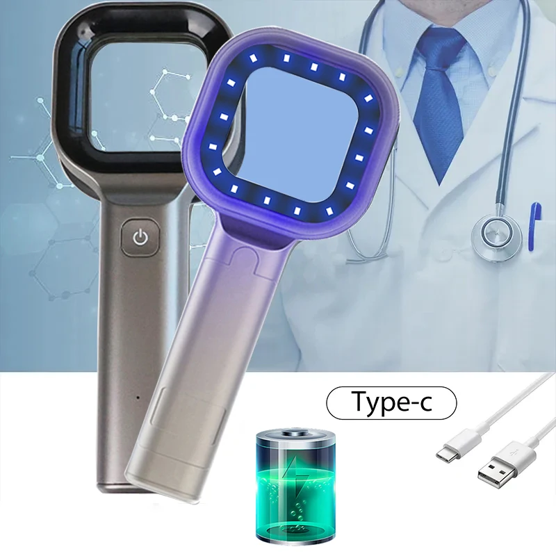 Handheld Wood Lamp for Pet Cat and Dog Skin Detection 365 Nanometer UV Irradiation Veterinary Equipment