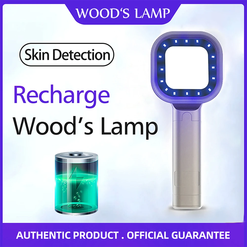 Handheld Wood Lamp for Pet Cat and Dog Skin Detection 365 Nanometer UV Irradiation Veterinary Equipment