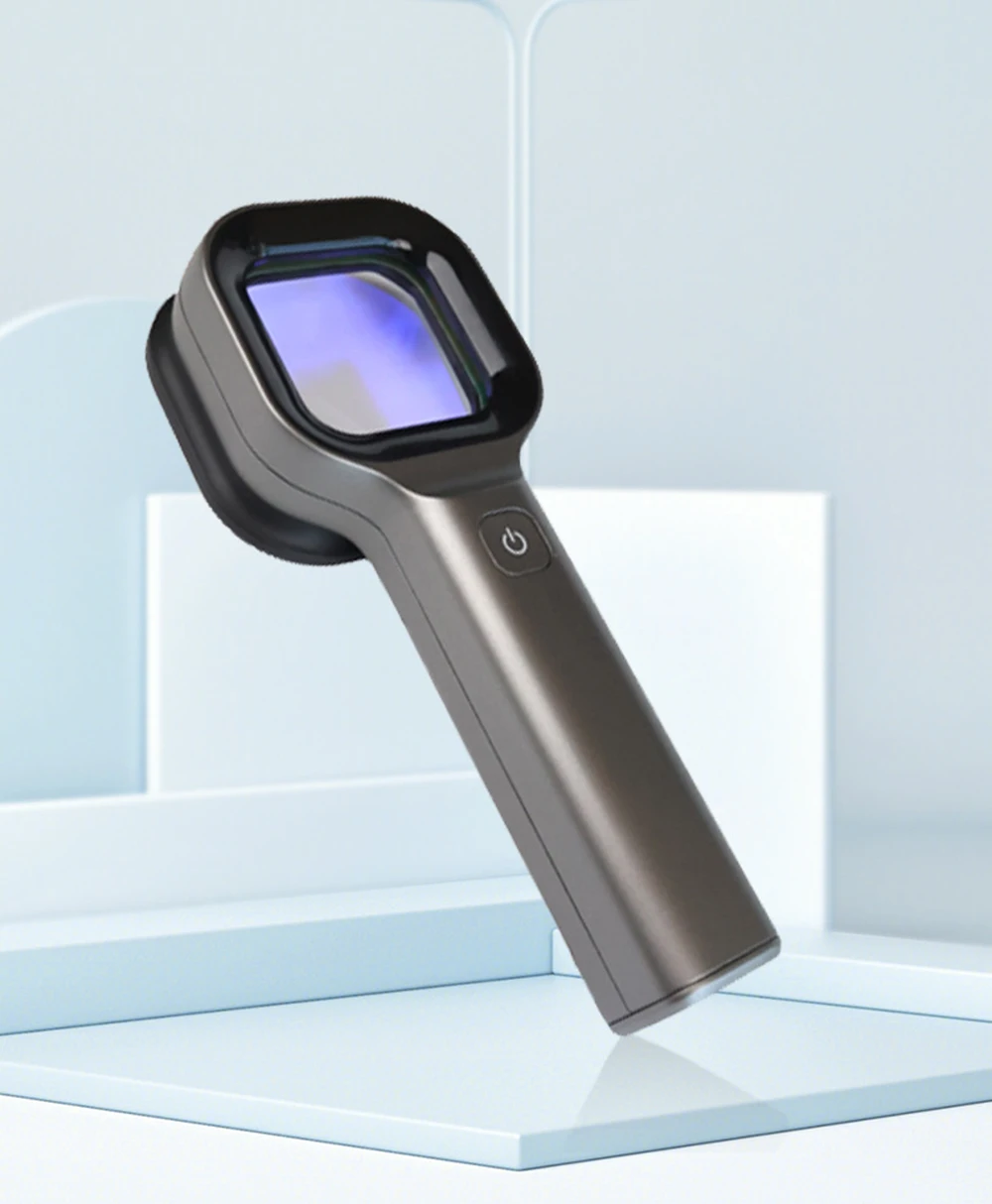 Handheld Wood Lamp for Pet Cat and Dog Skin Detection 365 Nanometer UV Irradiation Veterinary Equipment