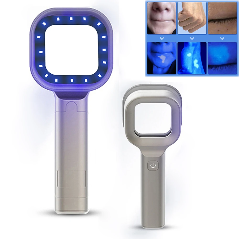 Handheld Wood Lamp for Pet Cat and Dog Skin Detection 365 Nanometer UV Irradiation Veterinary Equipment