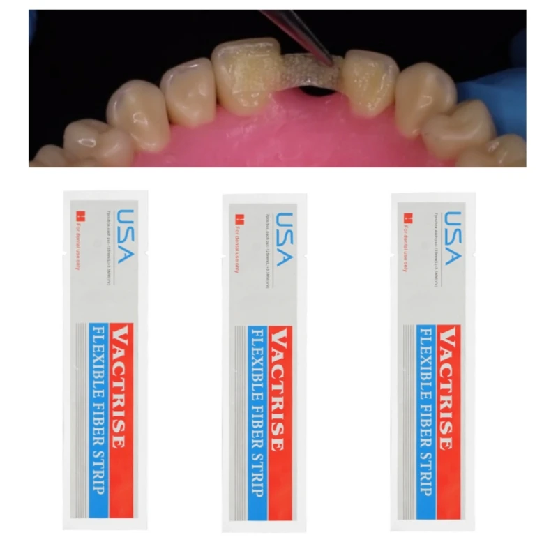 3Pcs Dental Material Flexible Fiber Strip Glass Splint Loose Tooth Fixation Strips Light Cure Bonding Orthodontic Retainers