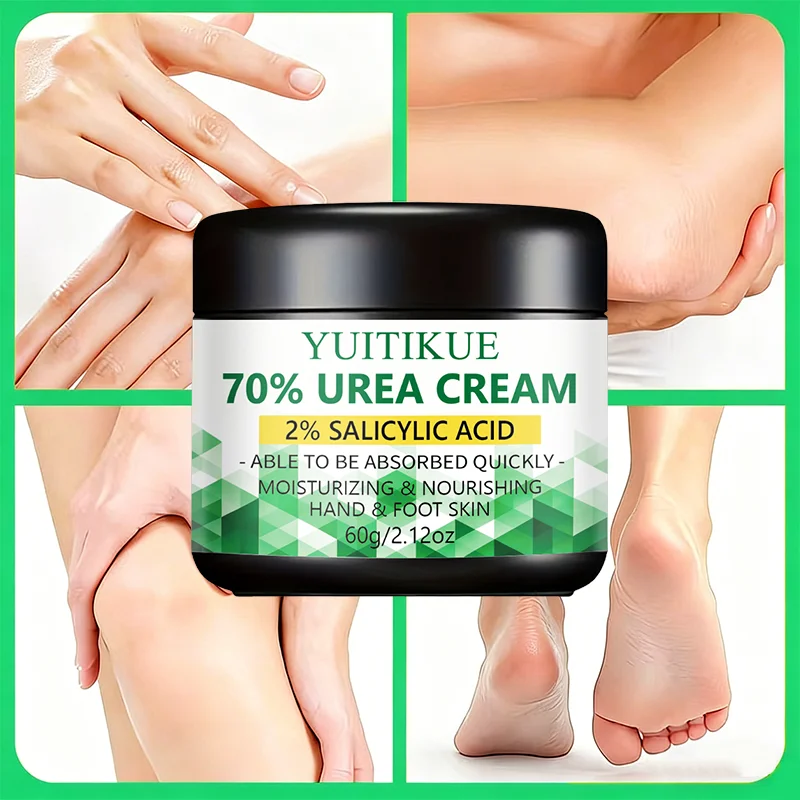 70 Urea 2% Salicylic Acid Foot Hand Cream Remove Dead Skin Soften Calluses Hydrate Chapped Dry Skin Fast Absorb Body Lotion