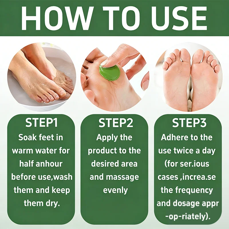 70 Urea 2% Salicylic Acid Foot Hand Cream Remove Dead Skin Soften Calluses Hydrate Chapped Dry Skin Fast Absorb Body Lotion