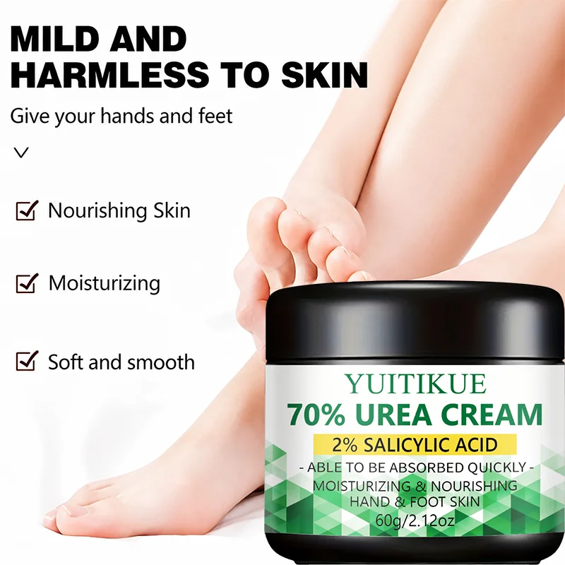 70 Urea 2% Salicylic Acid Foot Hand Cream Remove Dead Skin Soften Calluses Hydrate Chapped Dry Skin Fast Absorb Body Lotion