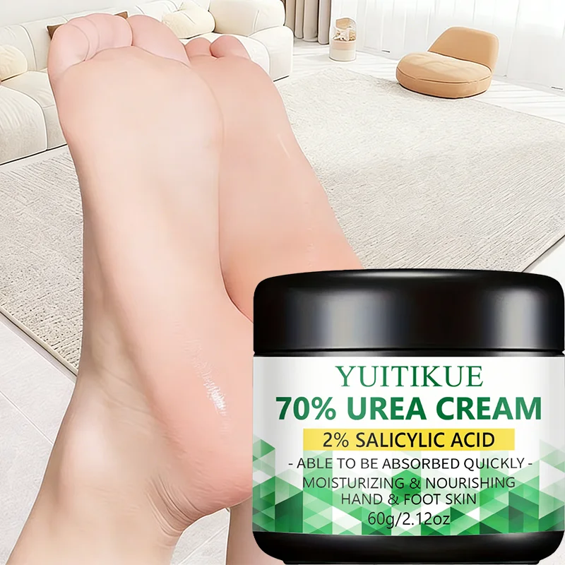 70 Urea 2% Salicylic Acid Foot Hand Cream Remove Dead Skin Soften Calluses Hydrate Chapped Dry Skin Fast Absorb Body Lotion