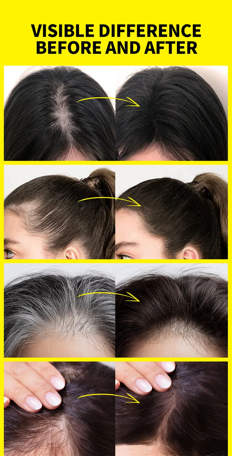 Sevich 5 Colors Concealer Hair Powder Waterproof Black Hairline Shadow Powder Edge Control Hair Concealer Hairline Powder 12g