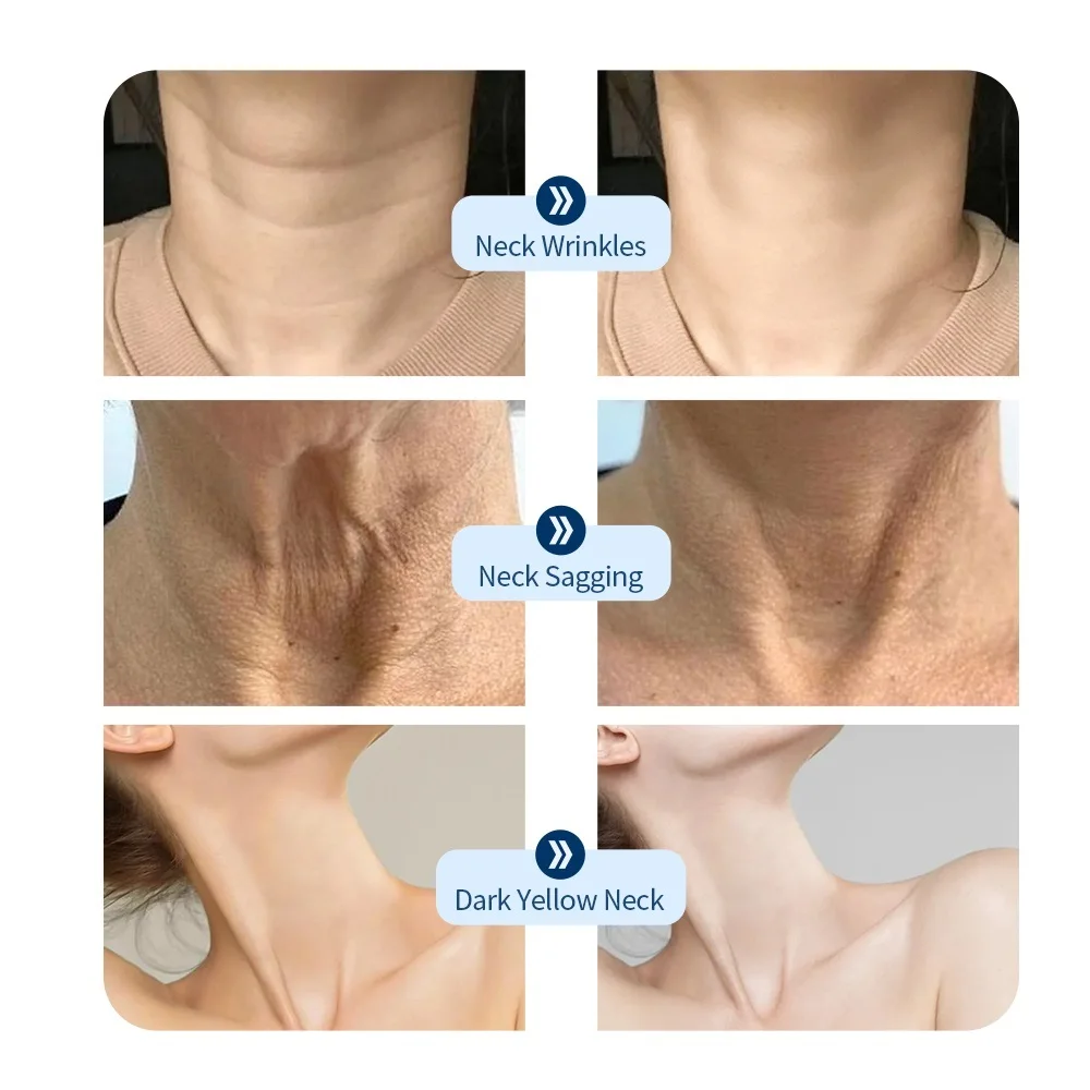 Neck LED Lift Mask Photon Anti-Wrinkle Skin Tightening Neck Beauty Device Skin Brighten Rejuvenation Neck Wrinkle Remover