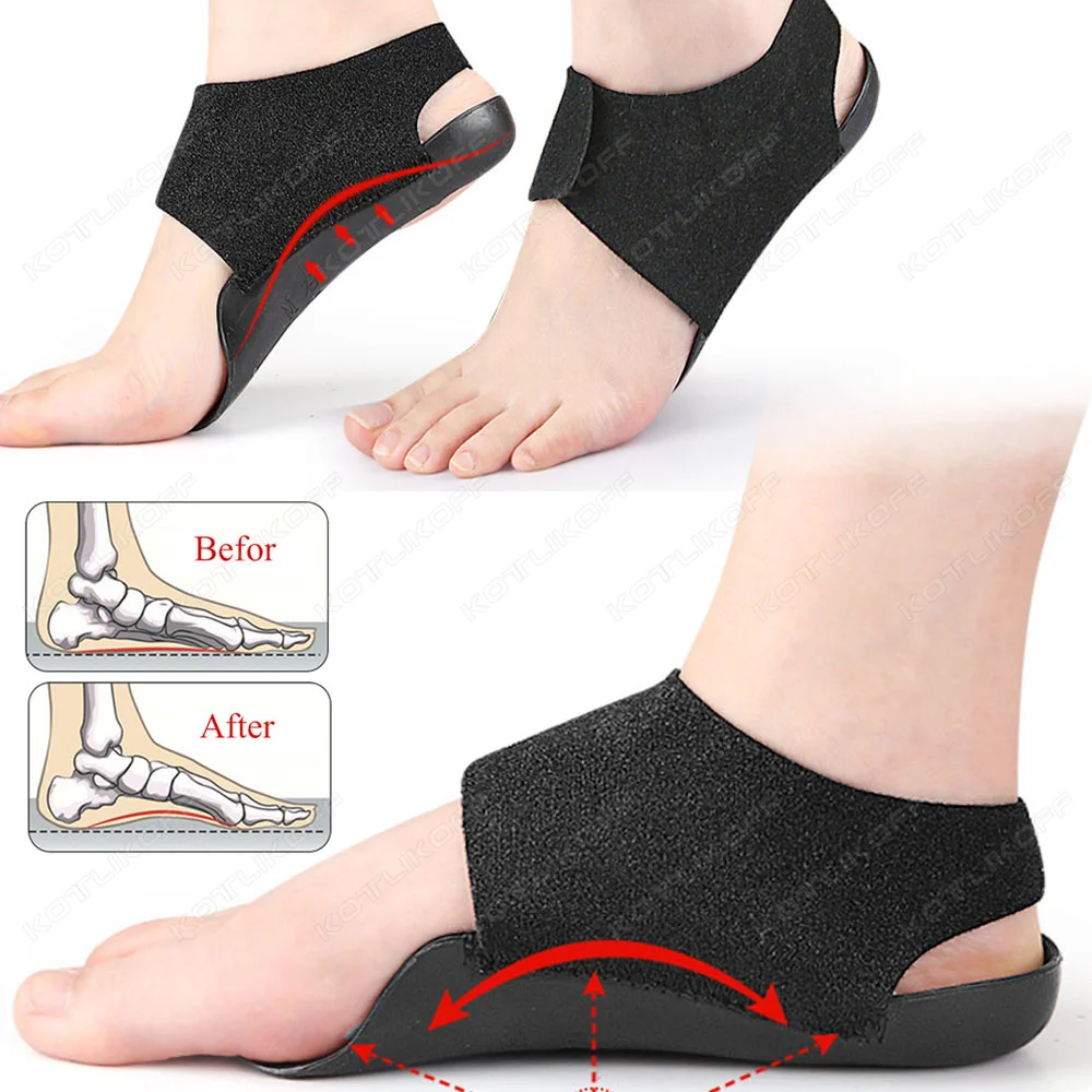 KOTLIKOFF 1 Pair Orthopedic Wearable Insoles For Flat Feet O-Shaped Unisex Pressure-relieving Walking Foot Care Arch Support Pad