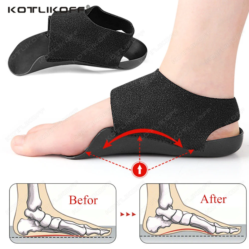 KOTLIKOFF 1 Pair Orthopedic Wearable Insoles For Flat Feet O-Shaped Unisex Pressure-relieving Walking Foot Care Arch Support Pad