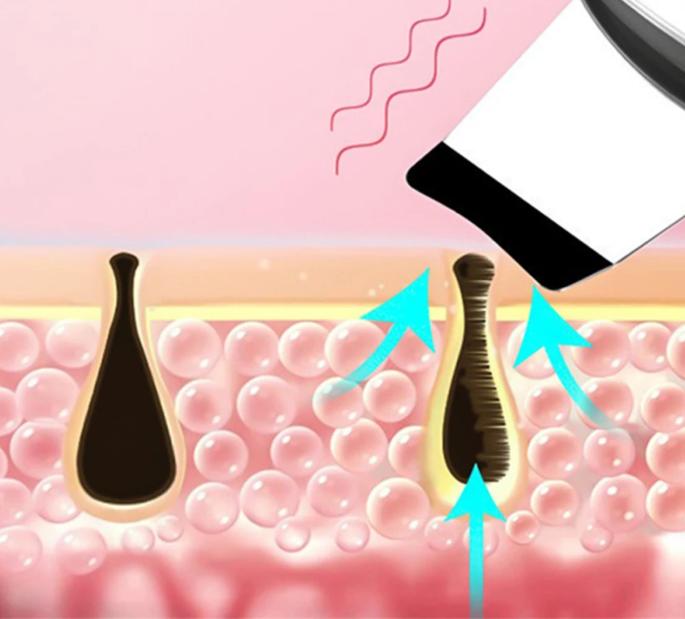 Ultrasonic Skin Scrubber Electric Facial Cleansing Pore Deep Cleanser Acne Blackhead Remover Peeling Shovel Device BeautyMachine