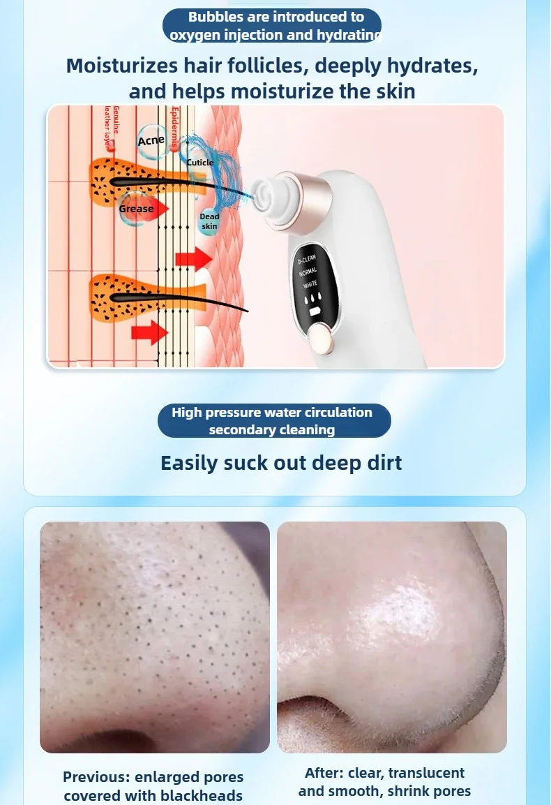 Blackhead Remover Pore Vacuum Face Cleaner Electric Pimple Acne Black Head Removal USB Rechargeable Water Cycle Black Dot Remove