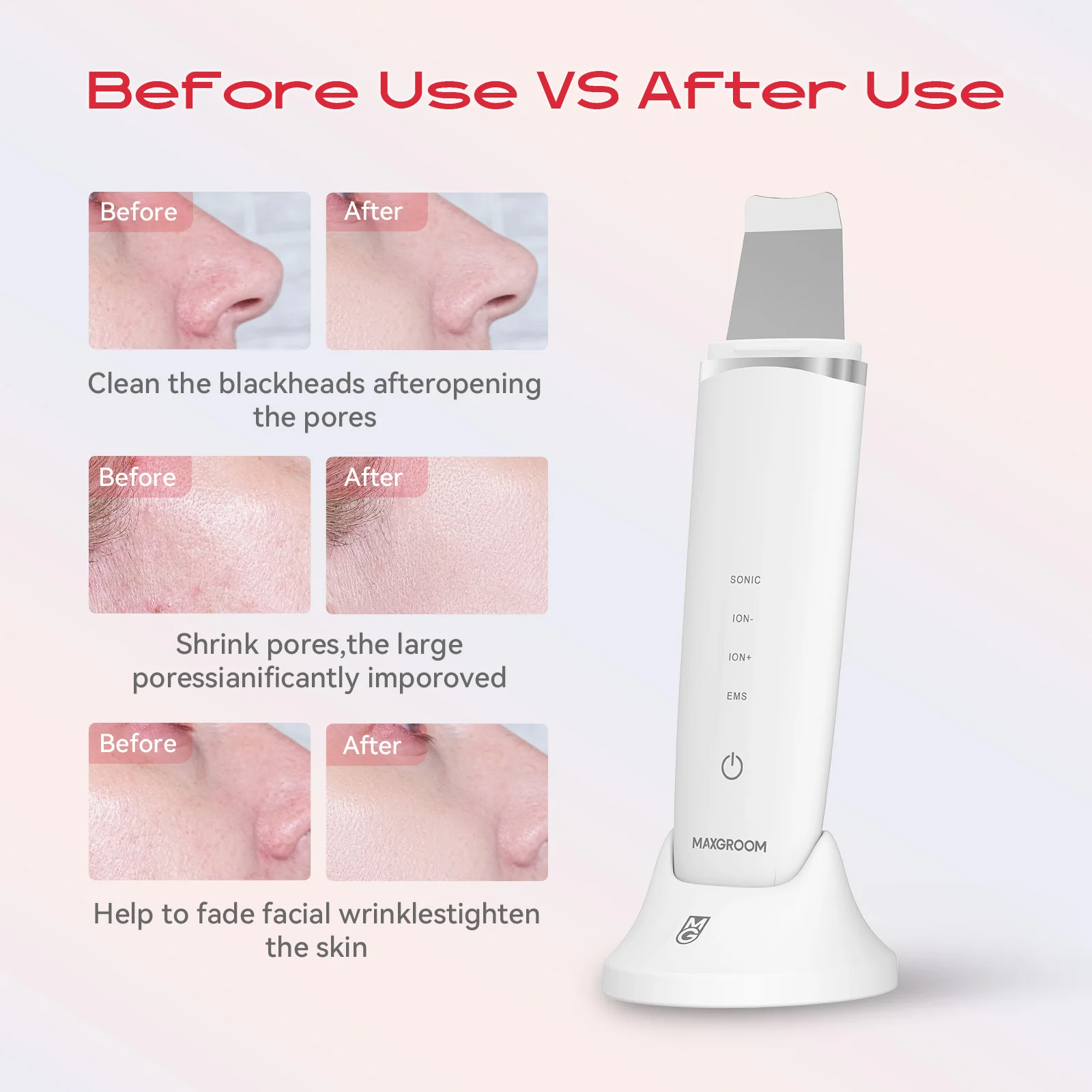 MAXGROOM Ultrasonic Skin Scrubber Peeling Blackhead Remover Deep Face Cleaning Ultrasonic Ion Acne Pore Cleaner Facial Shovel