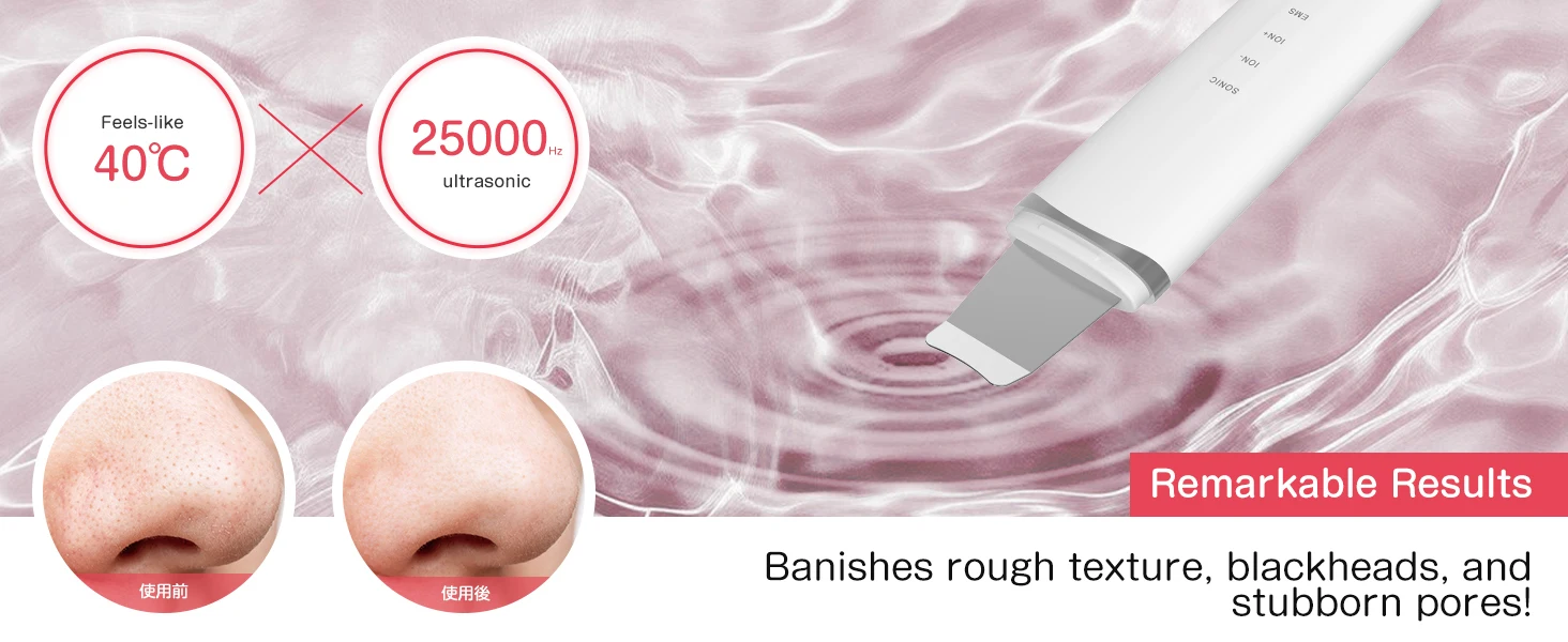 MAXGROOM Ultrasonic Skin Scrubber Peeling Blackhead Remover Deep Face Cleaning Ultrasonic Ion Acne Pore Cleaner Facial Shovel