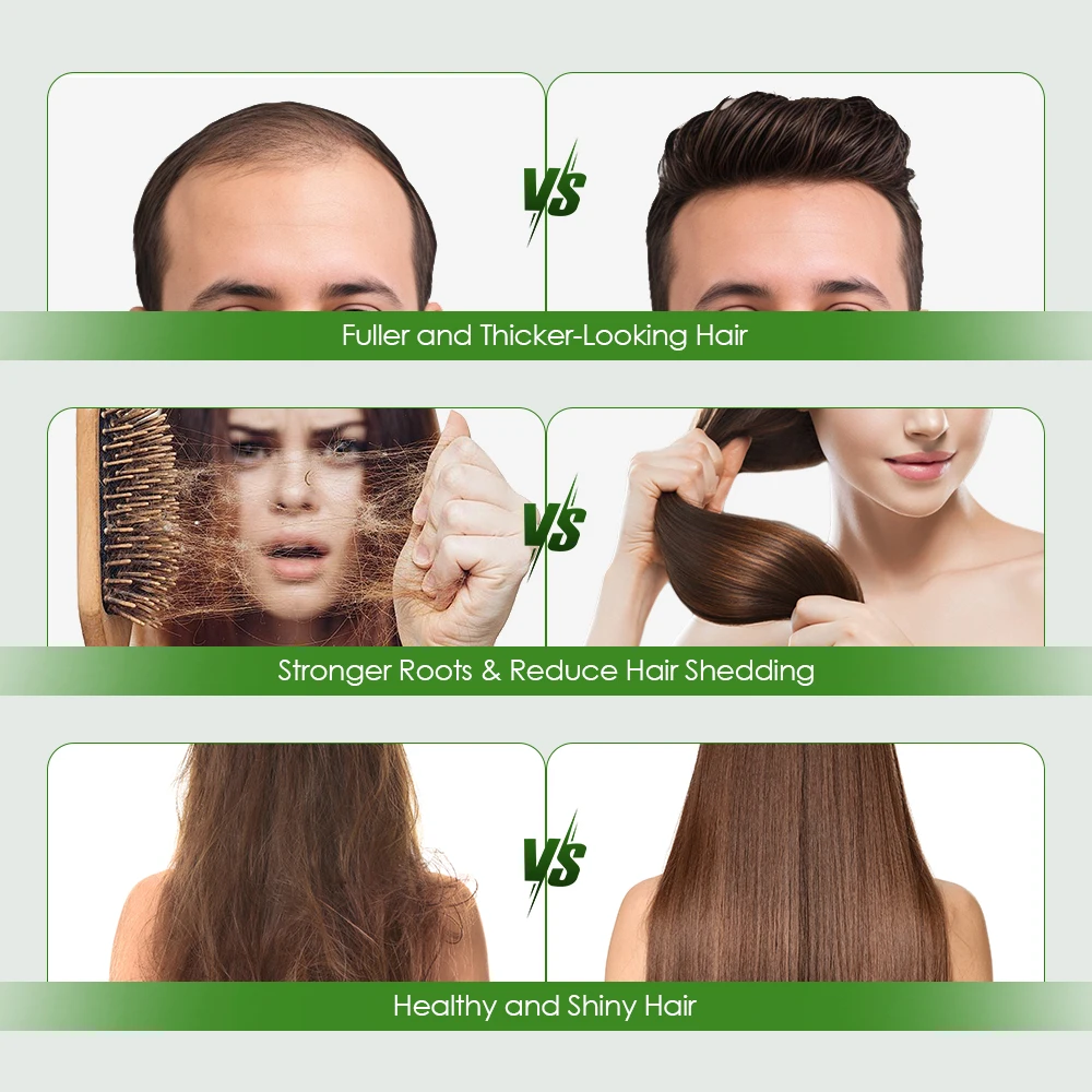 Hair Essential Care Serum Strengthen Roots Reducing Loss Prevent Baldness Nourish Scalp Hair Care Anti-Hair Loss Conditioner