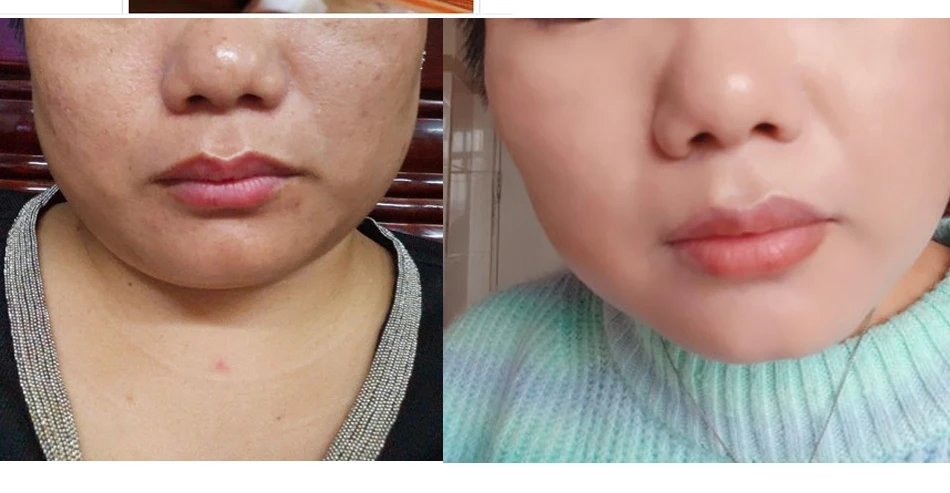 Recipe upgrade Ginseng Pearl Facial Cream Concealer Skin Care Skin Brighten Lady Cream