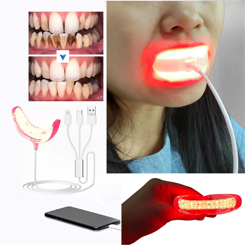 4 In1 USB Rechargeable Oral and Dental Care Red Light Whitening Teeth Bleach Clean Home Travel