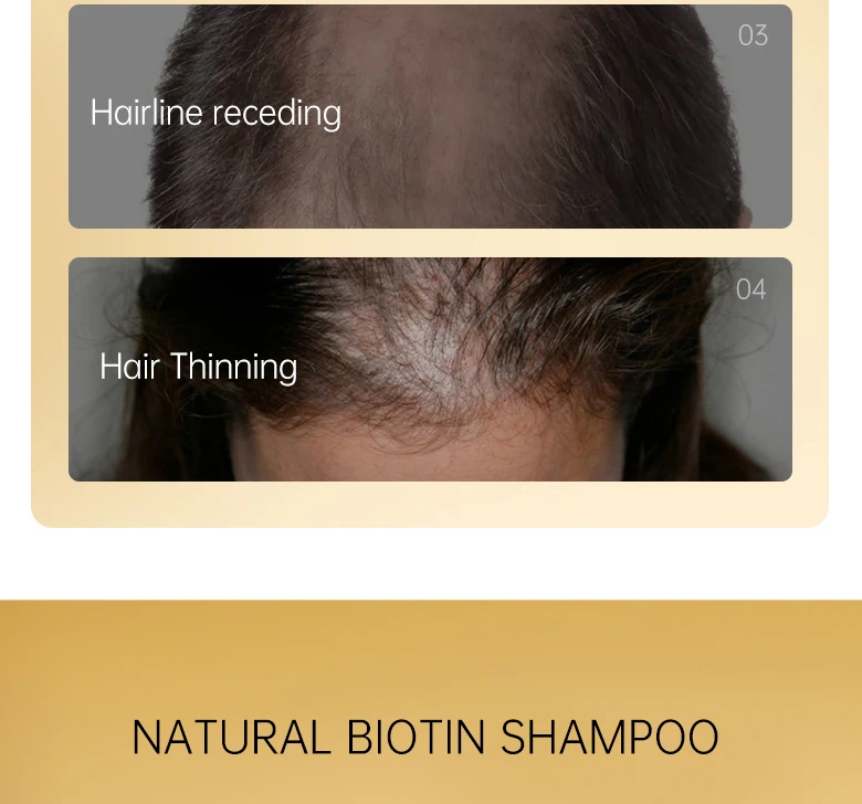 PURC 300ML Biotin Hair Shampoo Scalp Cleaning Nourishing Strengthen Roots Shampoos Hair Care Products for All Hair Types